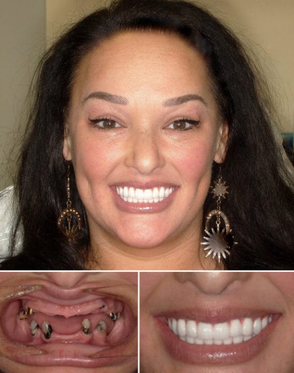 Cosmetic dentistry results - a confident smile, Jacksonville, FL
