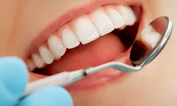 Close-up of bonded tooth or composite shade guide