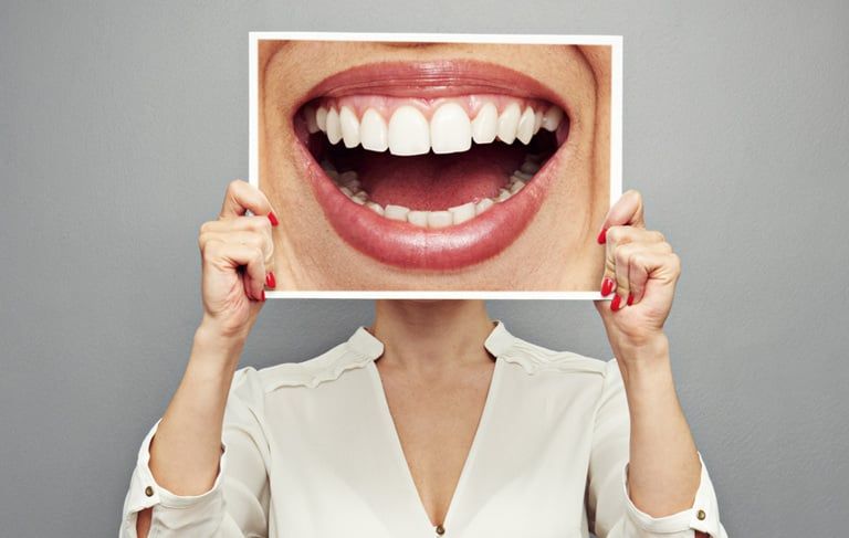 Porcelain veneer treatment planning and same-day veneer technology