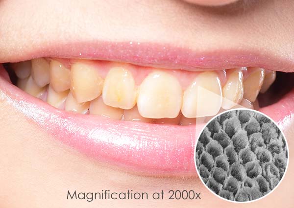 Coffee, wine, and tobacco staining tooth enamel